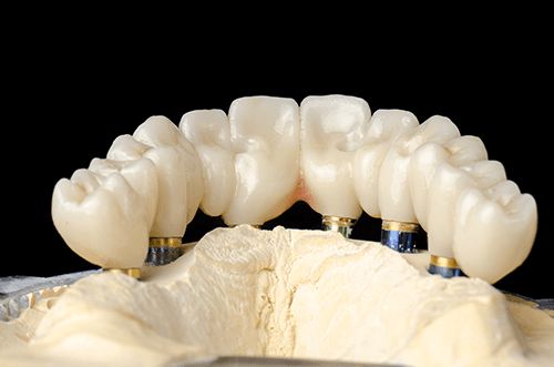 Katana™ UTML Zirconia with First Choice Dental Lab®