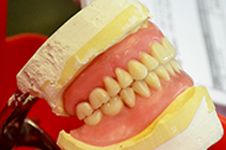 Full Dentures - First Choice Dental Lab
