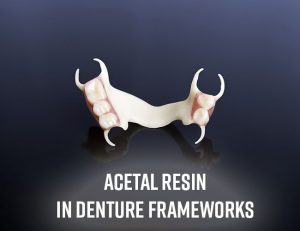 Denture Frameworks at First Choice Dental Lab® in Illinois