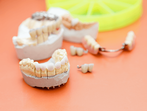 Zirconia Restorations - First Choice Dental Lab®