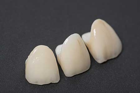 Zirconia Restorations - First Choice Dental Lab