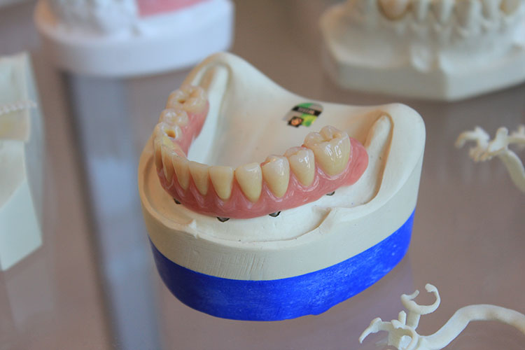 3d printers and dental technology
