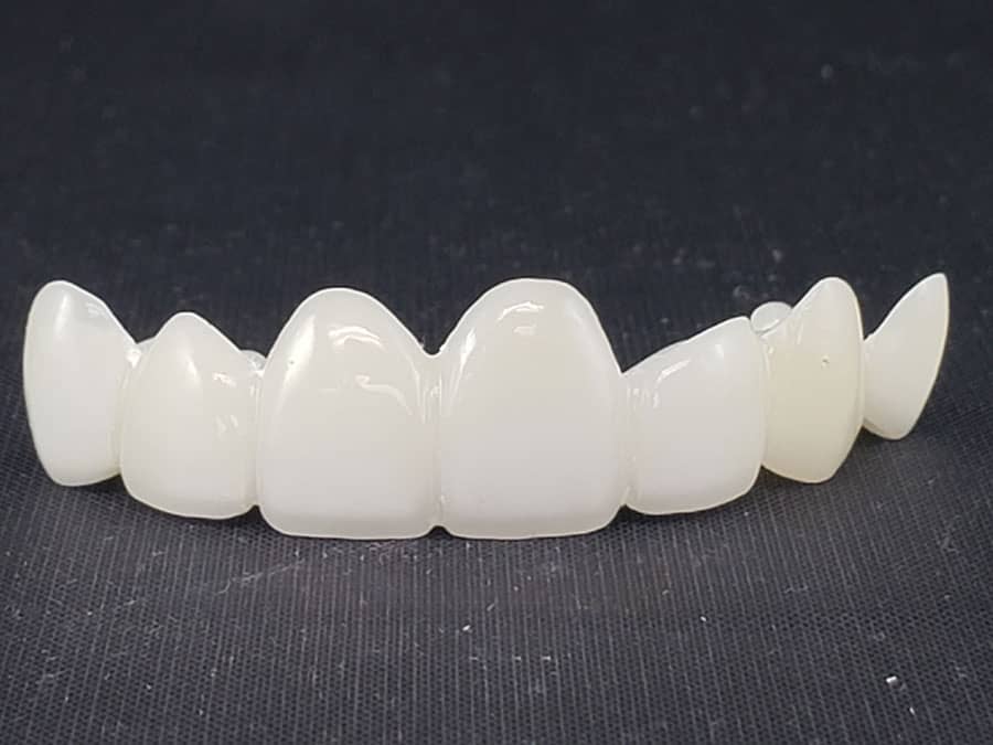 PMMA (polymethyl methacrylate) - Crown and bridge - First Choice Dental Lab