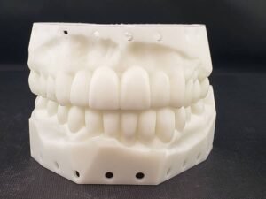 diagnostic wax-up - crowns and bridges - first choice dental lab