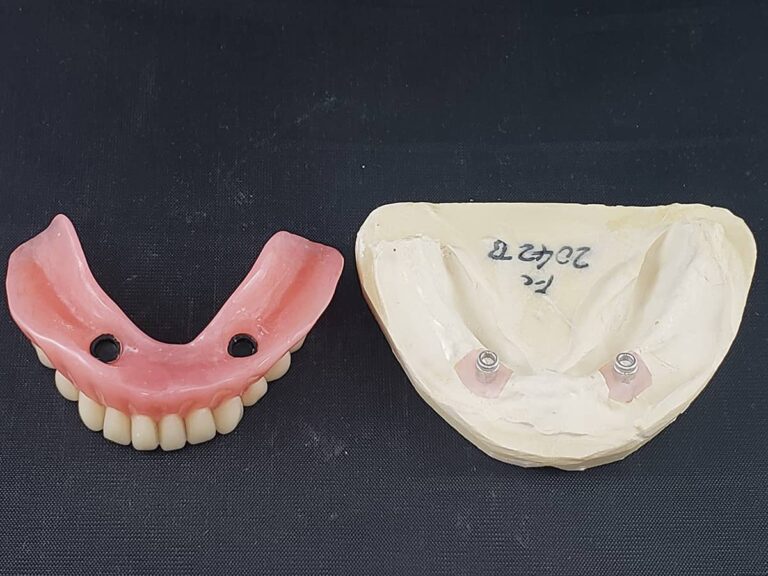 Removables Partials & Dentures First Choice Dental Lab