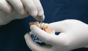 A close up image of two hands in white medical gloves holding a dental implant and inserting the implant onto a custom implant abutment
